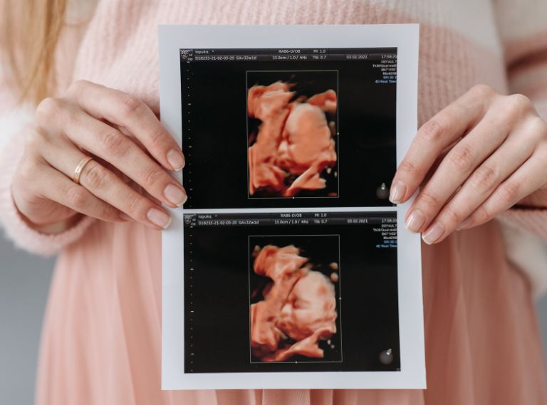 Ecografía 4D Ecografía 4D