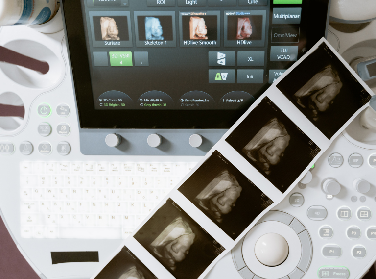 Ecografía obstétrica Ecografía obstétrica